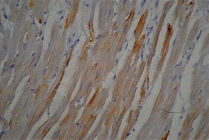 492 南方医科大学学报 J South Med Univ 文中n表示细胞数 组织切片显示 3 种亚型的 SK 通道在心房肌细胞 中均有阳性表达 且在细胞膜 细胞质和细胞核周围均 2 结果 有分布 图1 2.