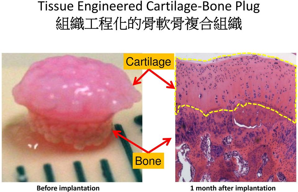 組 織 Cartilage Bone Before