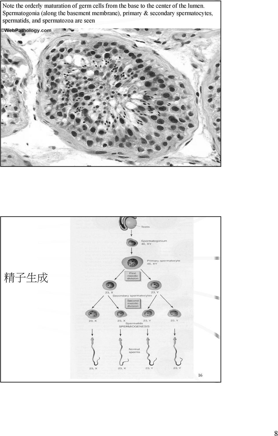 Spermatogonia (along the basement membrane), primary