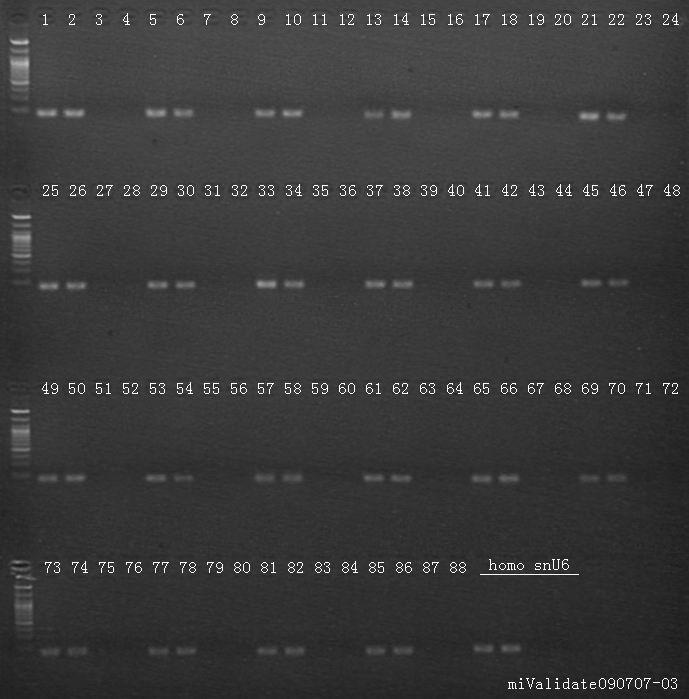snu6 (contains two positive controls and two NTC) (5 μl of the PCR of products, run on 3% agarose gel) 该产品仅限于实验科学研究用,