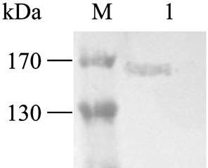 474 ISSN1000-3061 CN11-1998/Q Chin J Biotech April 25, 2010 Vol.26 No.4 chapn 蛋白浓度为 4.8 mg/ml Western blotting 分析鉴定, 显示获得良好带 His 标签目的蛋白, 表明获得高表达量的目的蛋白 ( 图 6) 2.