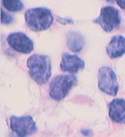 淋巴细胞 (lymphocyte)