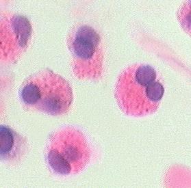 Eosinophilic leukocyte