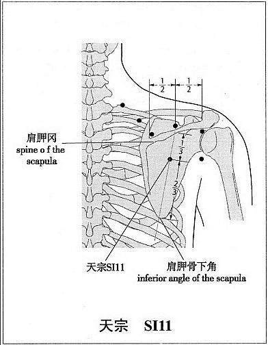 2. 天宗 (SI 11) 定位 在肩甲区, 肩胛冈中点与肩胛骨下角连线上 1/3 与下 2/3