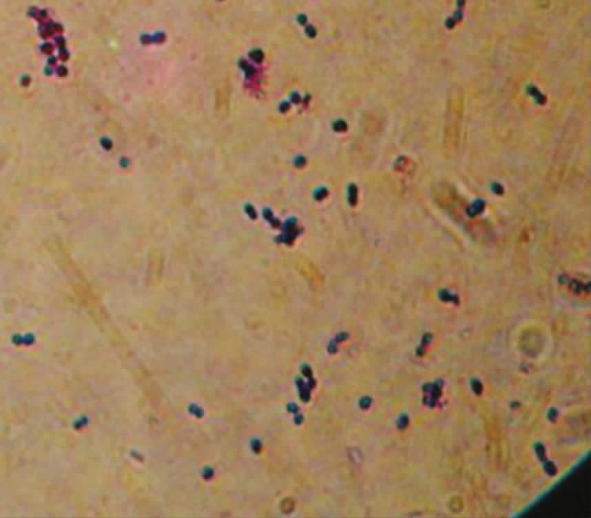 停乳链球菌的菌落形态 Ｆ ３ Ｃ ｎ ｍ ｐｈ ｇｙｓ ｄ ｙ ｇ 图 ４