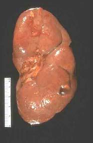 肾 Kidney 构造肾实质 : 皮质 renal cortex: 肾小体肾小管髓质