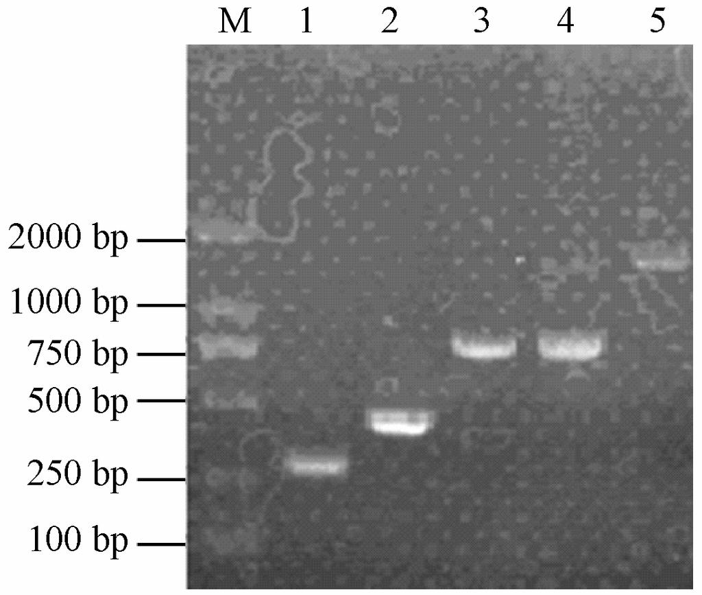 李致科等: 抗 VEGFR-2 全人源 IgG1 抗体的构建及其在 CHO-k 细胞中的表达 1547 有条带, 同时阳性对照 (scfv-fc 融合抗体, 图 4B, lane 2) 在 60 kd 处有条带, 阴性对照 CHO-k 细胞培 养上清液呈阴性反应 (图 4B, lane 3), 说明瞬时转染 的 Mab-04 没有在细胞内发生装配错误, 且其表达量 约为 1 μg ml 1