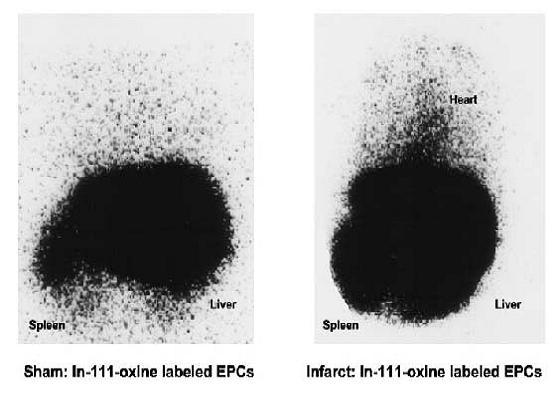 核素针孔成像 Human endothelial progenitor cells in rat MI model 信号衰减的潜在问题 : 1) [ 111 In]-indium oxine