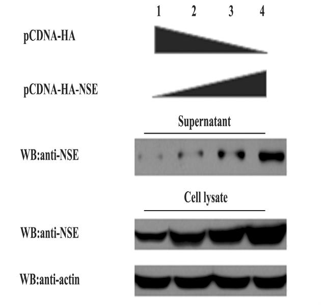 粒的量增加而增多( 图 3) 2 3 NSE 抗体免疫荧光检测 WB 检测表明在许 多不同癌细胞株中都有 NSE 的大量表达 ( 结果未在 NSE 真核表达载体转染 HeLa 细胞 进行 WB 检测 结果在 50 kd 左右检测到了目的蛋白 NSE( 图 2A) 本文显示) 用免疫荧光方法对图 4 中的 3 株细胞进 行检测 结 果 表 明 在 肺 癌 细 胞