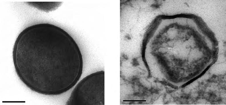 内容物泄漏而使菌体细胞干瘪 皱缩, 表面粗糙程度加重 ( 如图 5D 箭头所示 ), 另胞外可看到许多大而明显的附着在菌体上的白色分泌物, 推测是正在外泄的细胞内容物 ( 如图 5E 箭头所示 ) 2.5.2 CP7ACP 对 S12 作用的透射电镜观察 : S12 被 CP7ACP 的 2 倍稀释液处理 0.