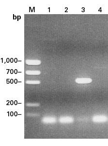 LONG GC PrimeSTAR GXL DNA Polymerase : 30 kb DNA :,~1 error/16,230 bp : GC/ AT rich, Hot start : Hot start antibody, Kit: buffer dntps : Long PCR, Sequencing, Cloning, Amplification Prior to NGS GC