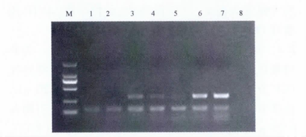 C. M. DNA 4 PCR PCR PCR 10% PCR 1. S. 2010 283. 2. J. 2012 37 21 3203. 3. J. 2 000 1 000 750 500 250 100 bp 1. 2. 3. 4. 5. 2010 29 844. 4. J. 2002 12 6 26. 6. 7. 8. 5. J. 2007 25 9.