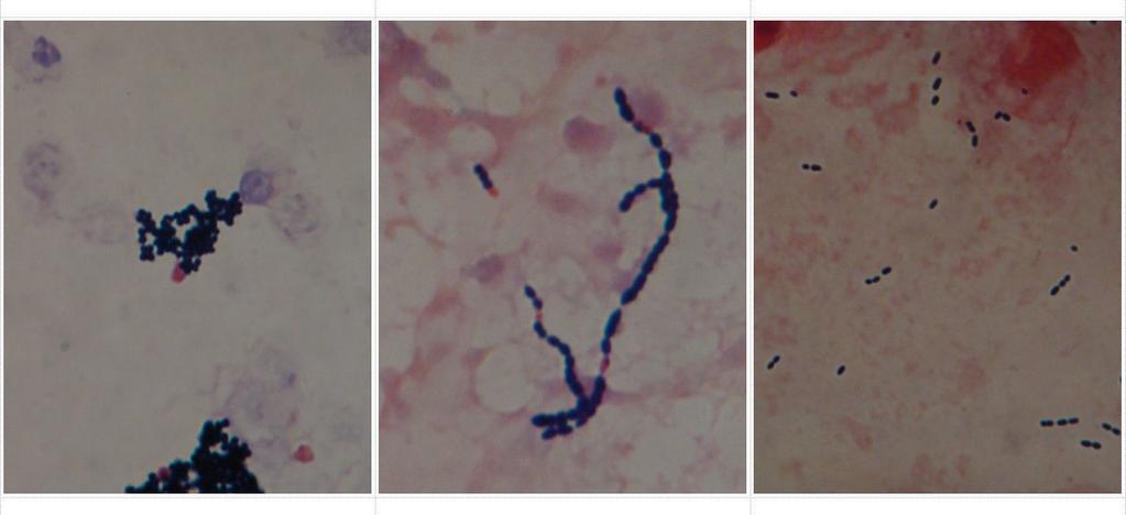 乙型鏈球菌 (Streptococcus agalactiae, Group B streptococcus, GBS) 鏈球菌屬 革蘭氏陽性鏈球菌