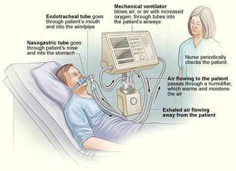 基本措施 (6) 维护呼吸机管路 - 仅在出现肉眼可见污渍或出现故障时更换呼吸机管路