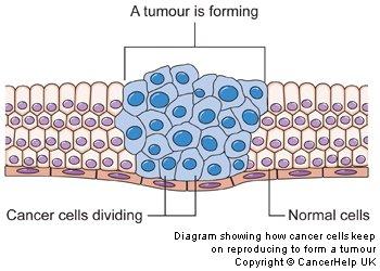 Cancer cells 4 http://www.cancerresearchuk.