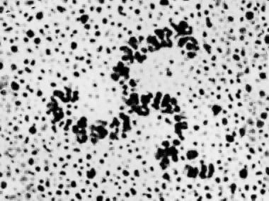 第一节 1. 网格蛋白包被囊泡 1. Individual clathrin molecules can be seen in the electron microscope as three-legged structures, called triskelions.