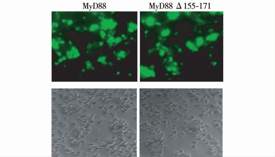 2008,28(9) 焦国慧等 :MyD88aa155?171 功能区缺失对免疫相关细胞共刺激分子和细胞因子表达的影响 5 图 5 MyD88,MyD88Δ155?171 载体转染树突细胞 并在荧光显微镜下观察表达 Fig.5 FluorescentmicrographofDCstransfected withmyd88andmyd88δ155?