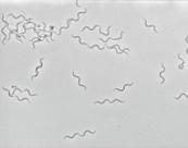 with fibrinous exudate 结肠炎纤维素性渗出物 Histologically: 组织学 Goblet cell hyperplasia,