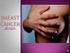 Microsoft PowerPoint - Estrogen Breast Cancer.ppt