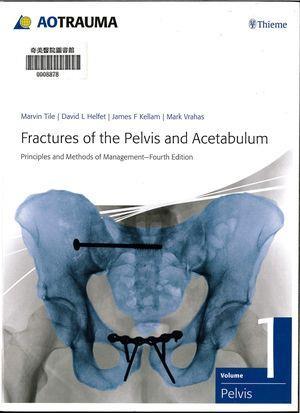 WE Musculoskeletal System 書名 :Fractures of the pelvis and acetabulum 作者