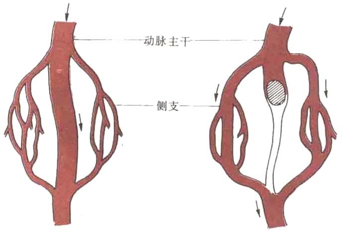 vascular