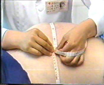 2. 孕妇健康状况评估 一般体格检查