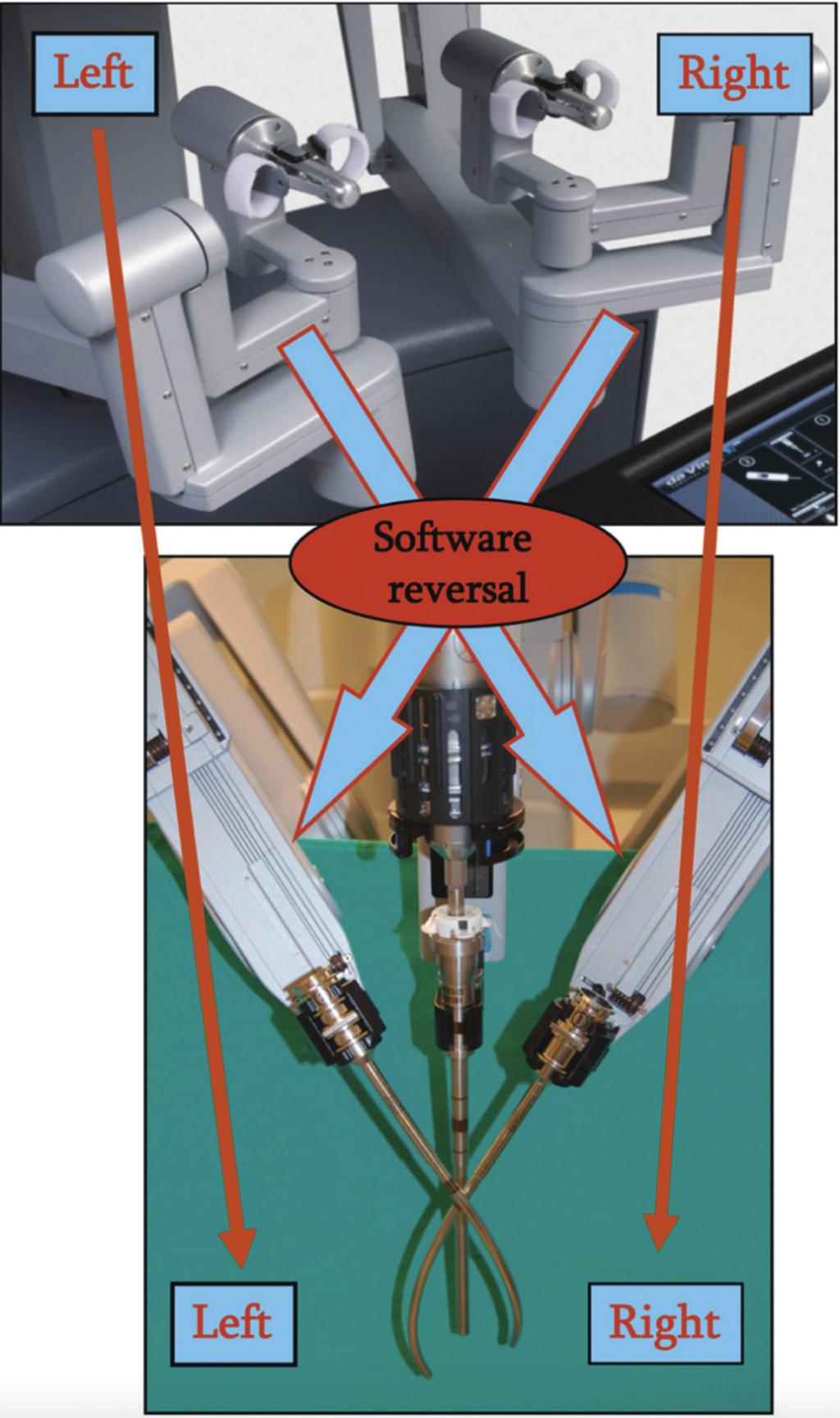 综述 Review 这套器械包括了一个四通道和一根外接充气管 制 如图 3 [12] 道的端口 两个通道可以弯曲的套管与机械臂 第 3 种 单 孔 机 器 人 平 台 也 是 来 自 Intuitive 相连接