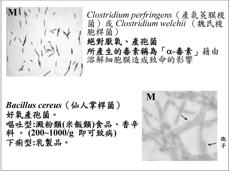 造 成 致 命 的 影 響 Bacillus cereus( 仙 人 掌 桿 菌 ) 好 氧 產 孢 菌 嘔 吐 型 : 澱 粉