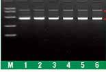 可以节省时间 提高产量分离出来的质粒 可以直接用于快速酶切 (FastDigest) 或常规酶切 测序 PCR 强健细胞系的体外转录和转染 GeneJet 质粒 纯化试剂盒的具体说明 质粒纯化试剂盒 小提 中提 大提 菌液体积 5ml 50ml 250ml 产量 20µg 200µg 750µg 浓度 400mg/µl 400mg/µl 400mg/µl 纯度 A 260 /A 280 1.