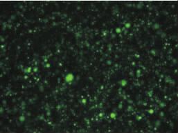 第 2 期 史春桃, 等.ZIC1 基因转染联合姜黄素对人乳腺癌细胞生物学行为的影响 115 D 值 - 空白 D 值 ) 100% 选取细胞抑制率最接近 50% 的姜黄素浓度, 作为后续实验的标准浓度 1.2.5 MTT 法检测各组 MDA MB 231 细胞的黏附率将转染空载体的对数生长期 MDA MB 231 细胞接种到 6 孔板, 细胞密度为 5 10 5 /ml, 放入 37,5% 的