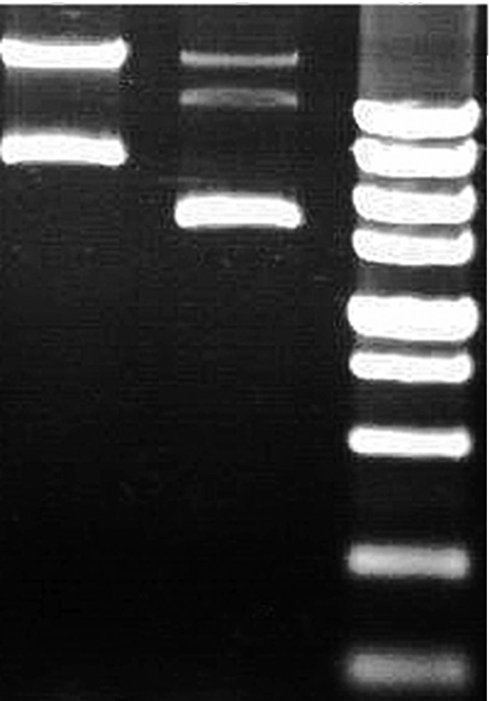 王腊梅 等/硬脂酰-辅酶 A 脱氢酶基因在食品级乳酸菌中的表达 同时 用 Sartorius PB-10 ph 湿度计测量发酵液 ph 值 1.12 统计分析 实验重复了 4 次 测量的数据用统计分析软 件 SAS (1999) 平均数通过 MEANS 语句列出 分析结果 x ± s 表示 2 结果 2.