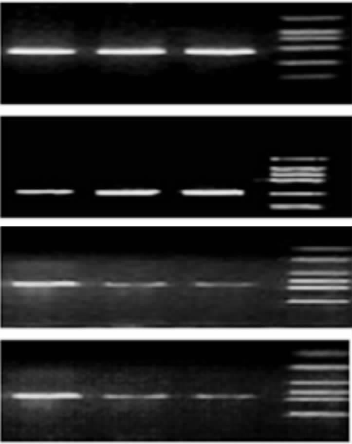 70, 及蛋白 均 详见下文 以下实验中仅选择 克隆组作为研究对象 阳性细胞克隆鉴定 (;,;01 质粒经 0 和 & 双酶切及 0 单酶切鉴定 结果显示!