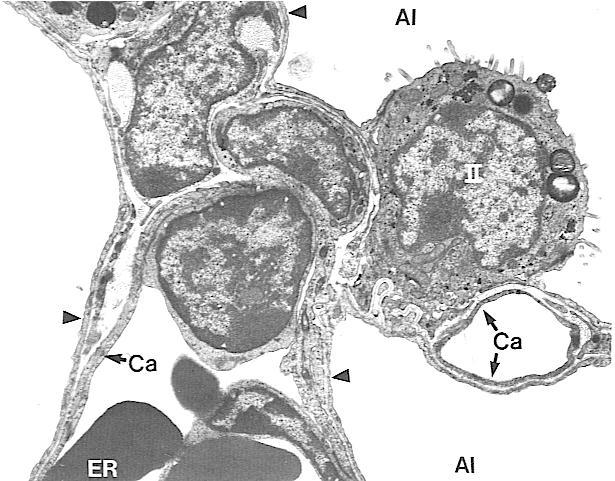 II 型肺泡细胞 EM: 细胞表面有少量微绒毛 线粒体