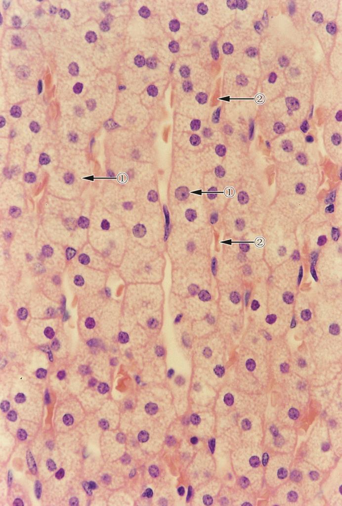 束状带 (zona fasciculata) 分布 最厚 (78%) LM 排列成单或双行的细胞索 细胞大, 多边形, 核大而圆, 染色浅,