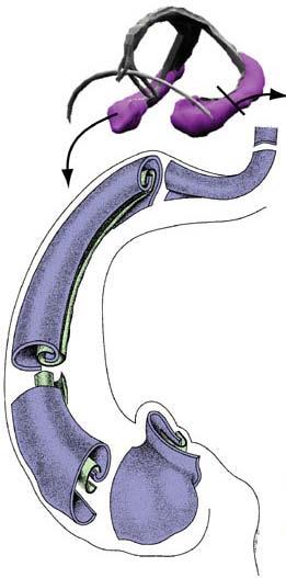 Structure of hippocampus Dentate gyrus Hippocampus (proper), cornu ammonis