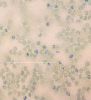 网织红细胞 (reticulocyte): 即外周血中未完全成熟的红细胞 体积略大于成熟红细胞, 但光镜下与之不易区分 用煌焦油蓝染色,
