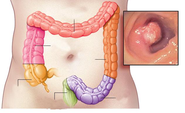 結直腸的構造與生理功能 大腸的長度約 90-150 公分, 從盲腸起始, 依序為升結腸 橫結腸
