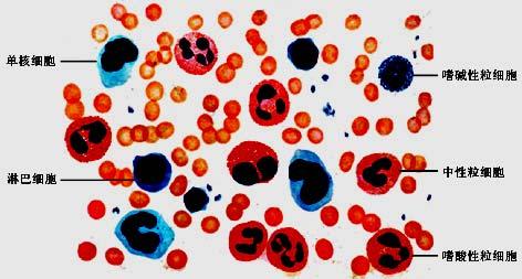 从血管内游出的白细胞称为炎细胞 炎细胞的种类 :
