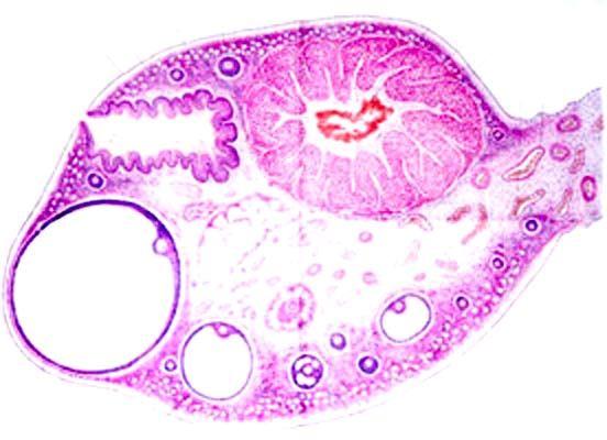 ( 四 ) 黄体 corpus luteum 成熟卵泡排卵后, 残留在卵巢内的卵泡壁塌陷形成皱襞,
