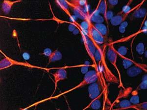 具有分化出多种细胞组织的 潜能 如造血干细胞 神经干细胞 胚胎干细胞