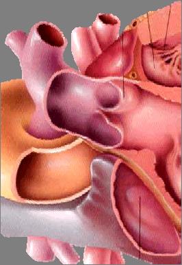 右心室 Right ventricle 分界 :supraventricular crest 室上嵴流出道 / 动脉圆锥 conus