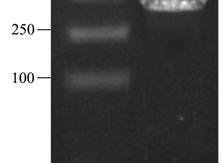 2 Electrophoretic profile of the PCR product of hlyz 注 :M 表示 DNA marker DL2000;1 表示 PCR product of hlyz 以质粒