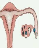 避孕节育的机制 * 干扰受精卵着床, 使子宫内环境不适宜孕卵生长 如 : 宫内节育器 * 阻止卵子和精子受精 :