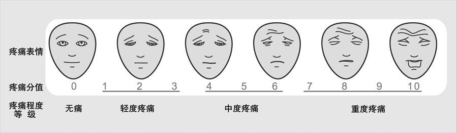 疼痛必须量化评估 面部表情疼痛评分量表