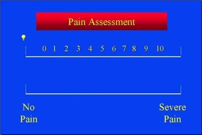 疼痛的评估疼痛评估 视觉模拟法 (VAS) 视觉模拟法 (VAS) 画一条直线 ( 一般为