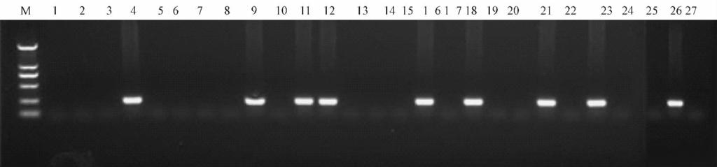 5 PCR 10 16 17 LAMP 18 3 43 min 4 Fig. 8 Detection of the PCR sensitivity of ETEC 27 2.