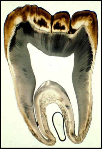 中山醫學大學牙醫學系 口腔胚胎與組織學講義 Cementum l 牙骨質是覆蓋在牙根表面的一層硬結締 組織 是維繫牙齒和牙周組織關係的重 要結構 是牙齒三個硬組織中