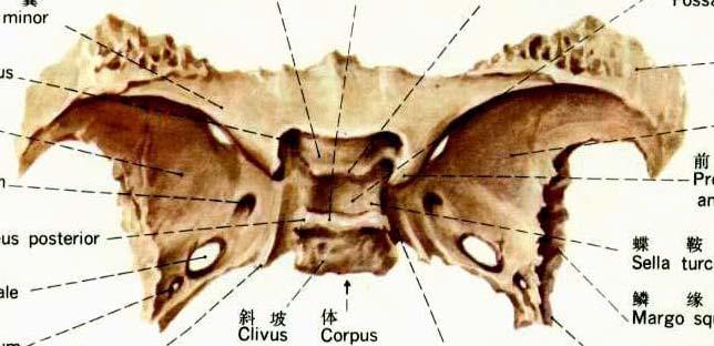 Cerebral Cranium