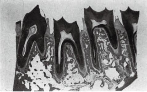 (osteoid) 在牙周韌帶的主纖維 (principal fibers) 內 成纖維細胞 (fibroblastic) 和 內皮細胞 (endothelial) 開始增殖 圖 11,12 Fig 10.