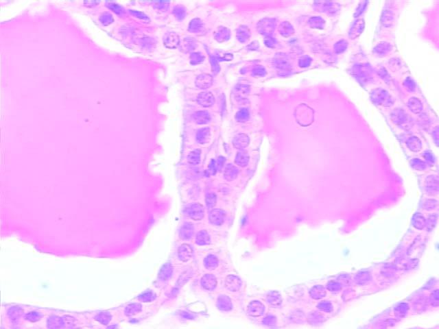 simple cuboidal epithelium colloid Normal thyroid seen microscopically